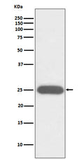Western blot analysis of G-CSF expression in K562 cell lysate.