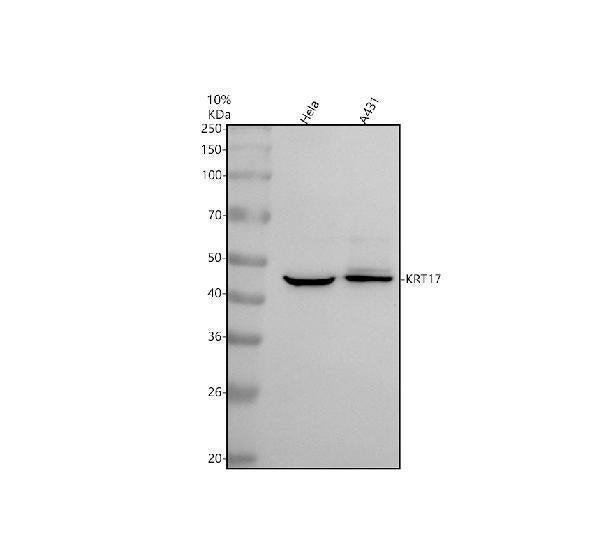 Anti-Cytokeratin 17 Rabbit Monoclonal Antibody
