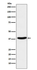 Western blot analysis of MT-ND1 expression in Human fetal muscle lysate.
