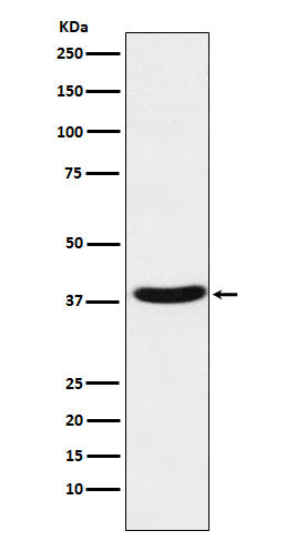 Western blot analysis of MT-ND1 expression in Human fetal muscle lysate.