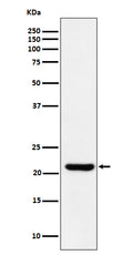Western blot analysis of ITPA expression in HepG2 cell lysate.