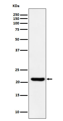 Western blot analysis of ITPA expression in HepG2 cell lysate.