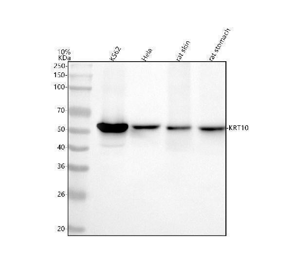 Anti-Cytokeratin 10 KRT10 Rabbit Monoclonal Antibody