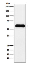 Western blot analysis of alpha 1 Antichymotrypsin expression in human plasma lysate.