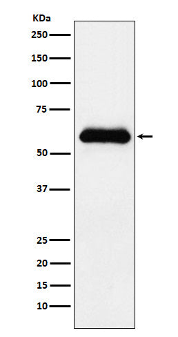 Western blot analysis of alpha 1 Antichymotrypsin expression in human plasma lysate.