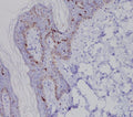 Immunohistochemical analysis of paraffin-embedded human skin, using Langerin (CD207) Antibody.