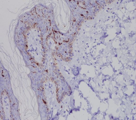 Immunohistochemical analysis of paraffin-embedded human skin, using Langerin (CD207) Antibody.