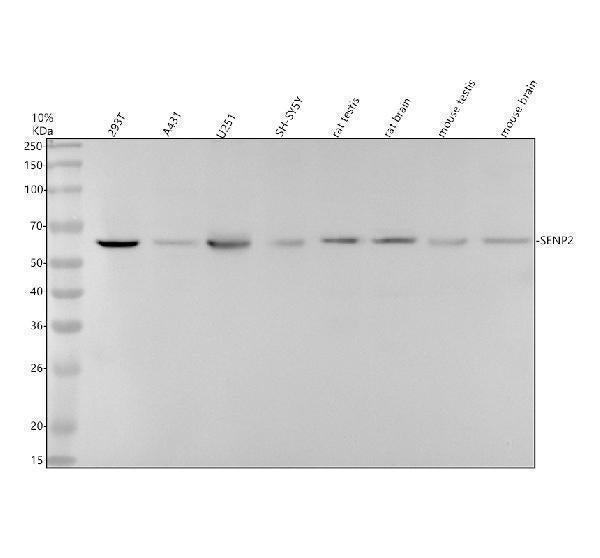 Anti-SENP2 Rabbit Monoclonal Antibody
