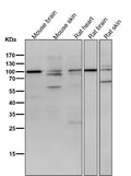 All lanes use the Antibody at 1:3K dilution for 1 hour at room temperature.