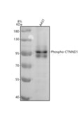 Anti-Phospho-CTNND1 (Y228) Rabbit Monoclonal Antibody