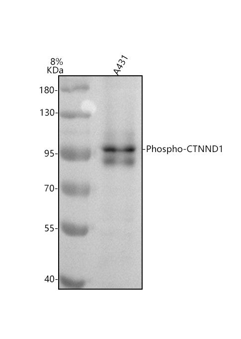 Anti-Phospho-CTNND1 (Y228) Rabbit Monoclonal Antibody