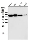 All lanes use the Antibody at 1:5K dilution for 1 hour at room temperature.