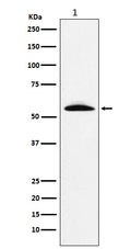 Western blot analysis of GGT1 expression in Human fetal liver lysate.
