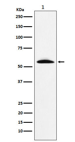 Western blot analysis of GGT1 expression in Human fetal liver lysate.