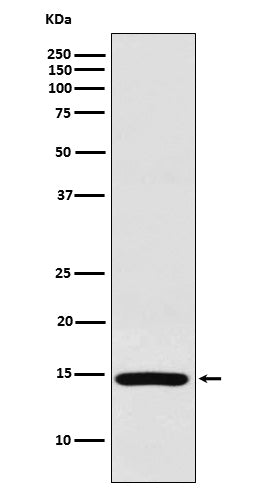 Western blot analysis of RPS19 expression in HeLa cell lysate.