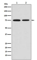 Western blot analysis of MSR1 expression in (1) HeLa cell lysate; (2) Mouse placenta lysate.