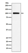 Western blot analysis of Transferrin Receptor 2 expression in HepG2 cell lysate.