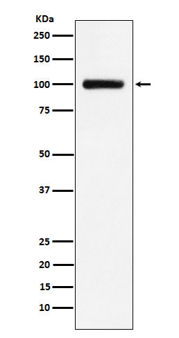 Western blot analysis of Transferrin Receptor 2 expression in HepG2 cell lysate.