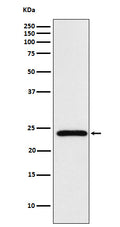 Anti-Mad2L2 Monoclonal Antibody