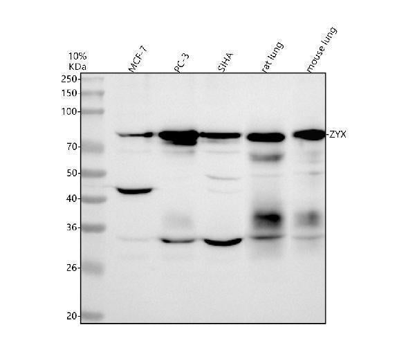 Anti-Zyxin Monoclonal Antibody