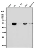 All lanes use the Antibody at 1:1K dilution for 1 hour at room temperature.
