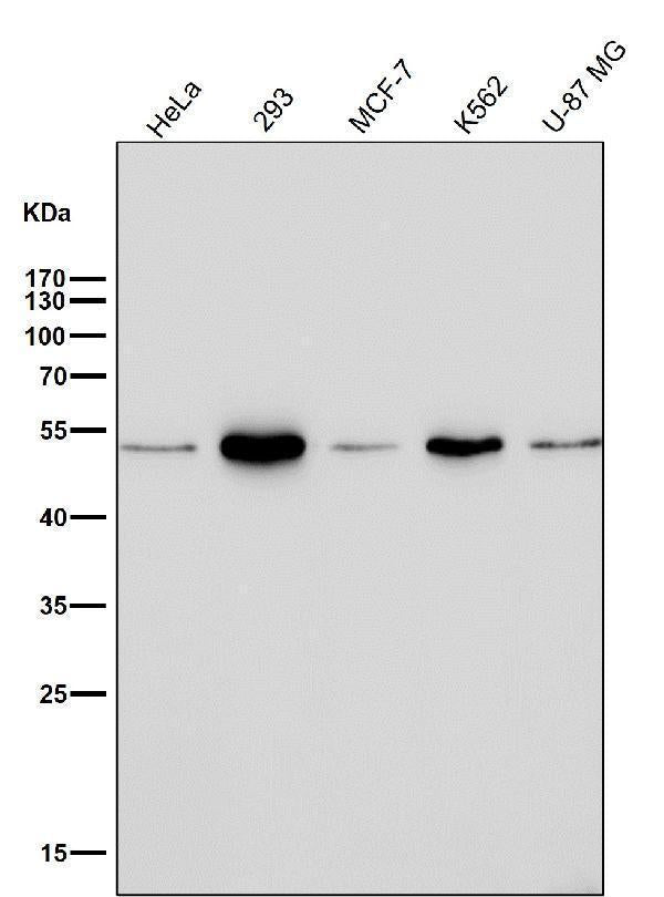 All lanes use the Antibody at 1:1K dilution for 1 hour at room temperature.