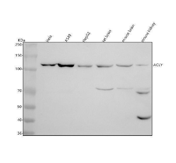 Anti-ATP citrate lyase ACLY Rabbit Monoclonal Antibody
