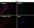 Anti-PFKFB3 Monoclonal Antibody