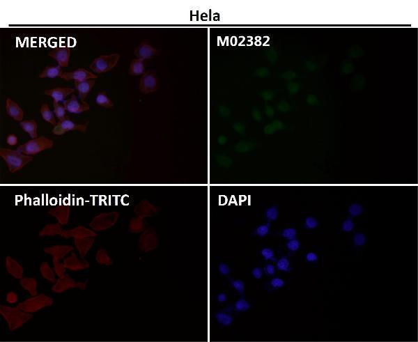 Anti-PFKFB3 Monoclonal Antibody