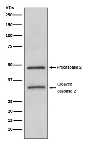 Western blot analysis of Caspase-2 expression in HeLa cell lysate.