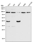 All lanes use the Antibody at 1:1K dilution for 1 hour at room temperature.