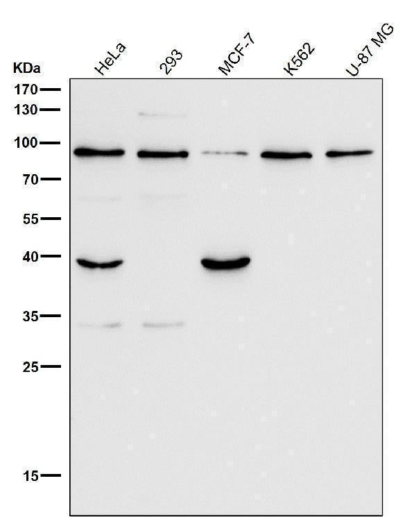 All lanes use the Antibody at 1:1K dilution for 1 hour at room temperature.