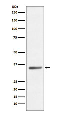 Western blot analysis of SIRT5 expression in HeLa cell lysate.