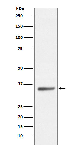 Western blot analysis of SIRT5 expression in HeLa cell lysate.