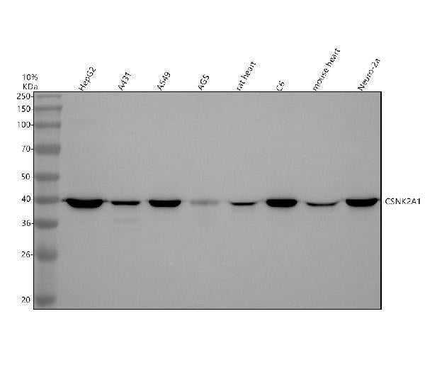 Anti-CKII alpha CSNK2A1 Rabbit Monoclonal Antibody
