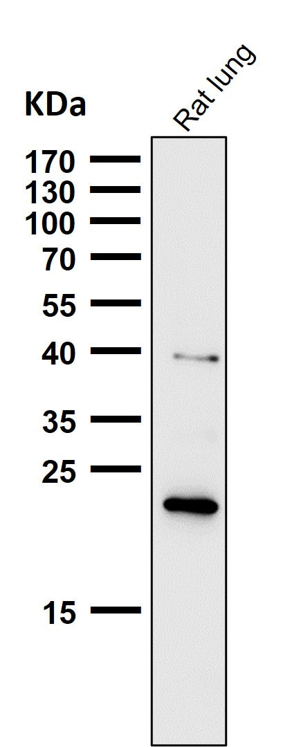 All lanes use the Antibody at 1:1K dilution for 1 hour at room temperature.