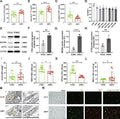 Anti-Ferritin FTH1 Rabbit Monoclonal Antibody