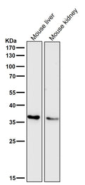 Anti-IGFBP7 Monoclonal Antibody