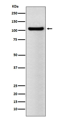 Western blot analysis of BRD2 expression in NCCIT cell lysate.