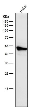 All lanes use the Antibody at 1:1W dilution for 1 hour at room temperature.