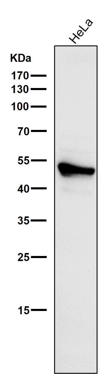 All lanes use the Antibody at 1:1W dilution for 1 hour at room temperature.