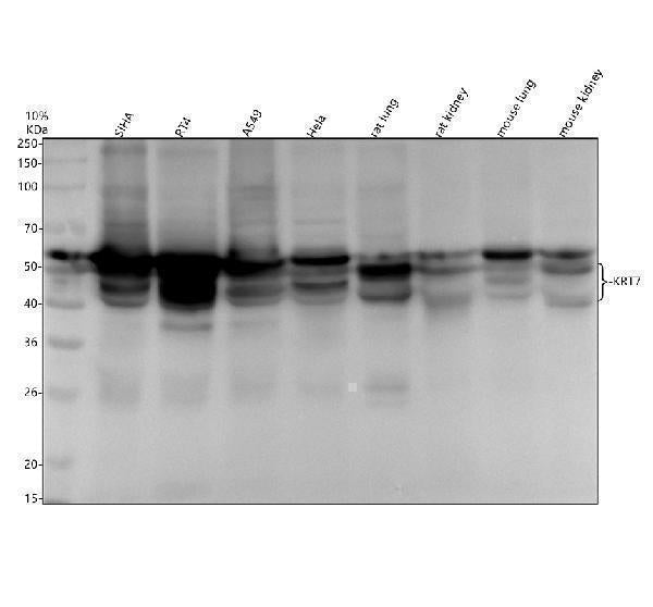 Anti-Cytokeratin 7 KRT7 Rabbit Monoclonal Antibody