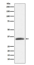 Western blot analysis of AMBP expression in human plasma lysate.