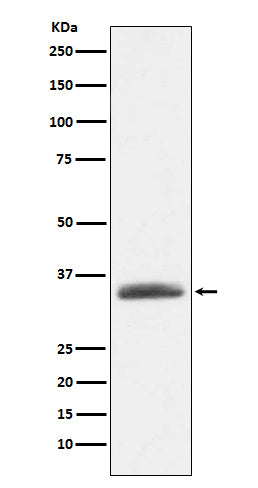 Western blot analysis of AMBP expression in human plasma lysate.