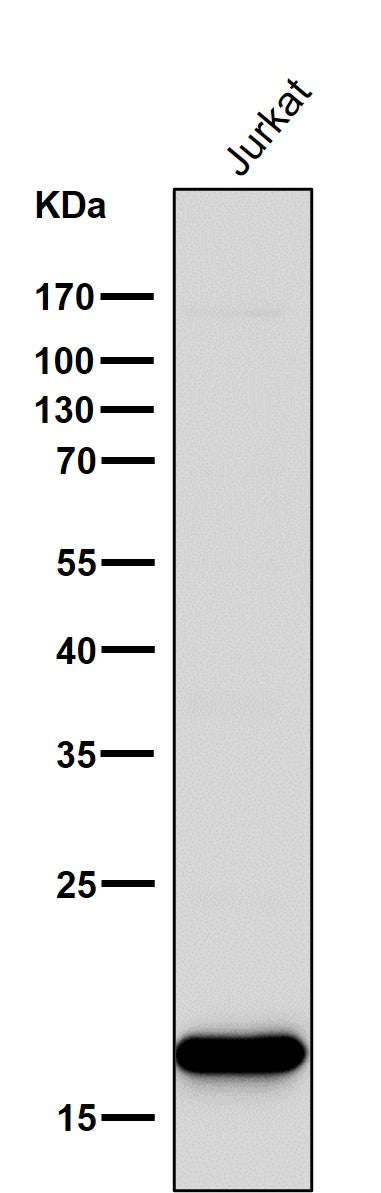 Anti-CD3 zeta CD247 Rabbit Monoclonal Antibody