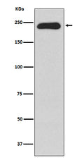 Western blot analysis of MYH11 expression in Human testis lysate.