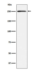 Western blot analysis of Myosin, smooth muscle heavy chain 1 and 2 expression in Human bladder lysate.