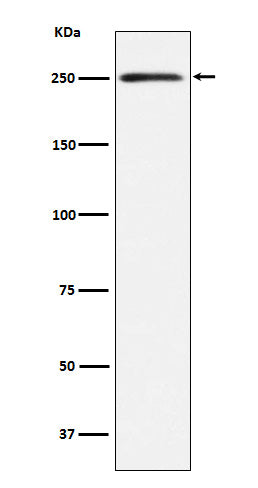 Western blot analysis of Myosin, smooth muscle heavy chain 1 and 2 expression in Human bladder lysate.