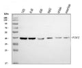 Anti-PCBP2/hnRNP E2 Antibody Picoband® (monoclonal, 4B9C7)