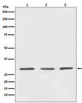 Western blot analysis of 14-3-3 expression in (1) HeLa cell lysate; (2) 3T3 cell lysate; (3) PC-12 cell lysate.